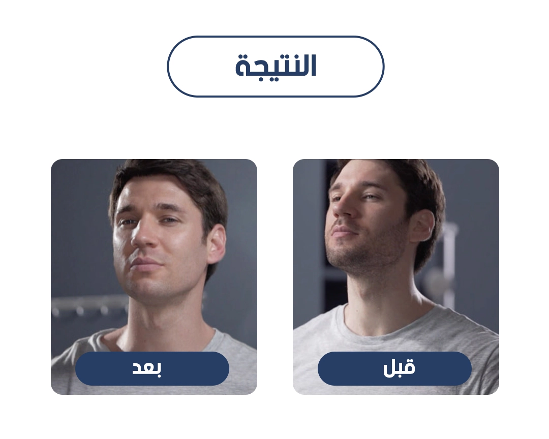 صورة المنتج